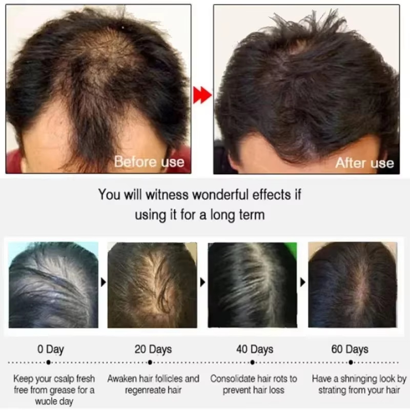 Сыворотка для роста волос: Быс – обзор и цена Epidermal Growth Factor