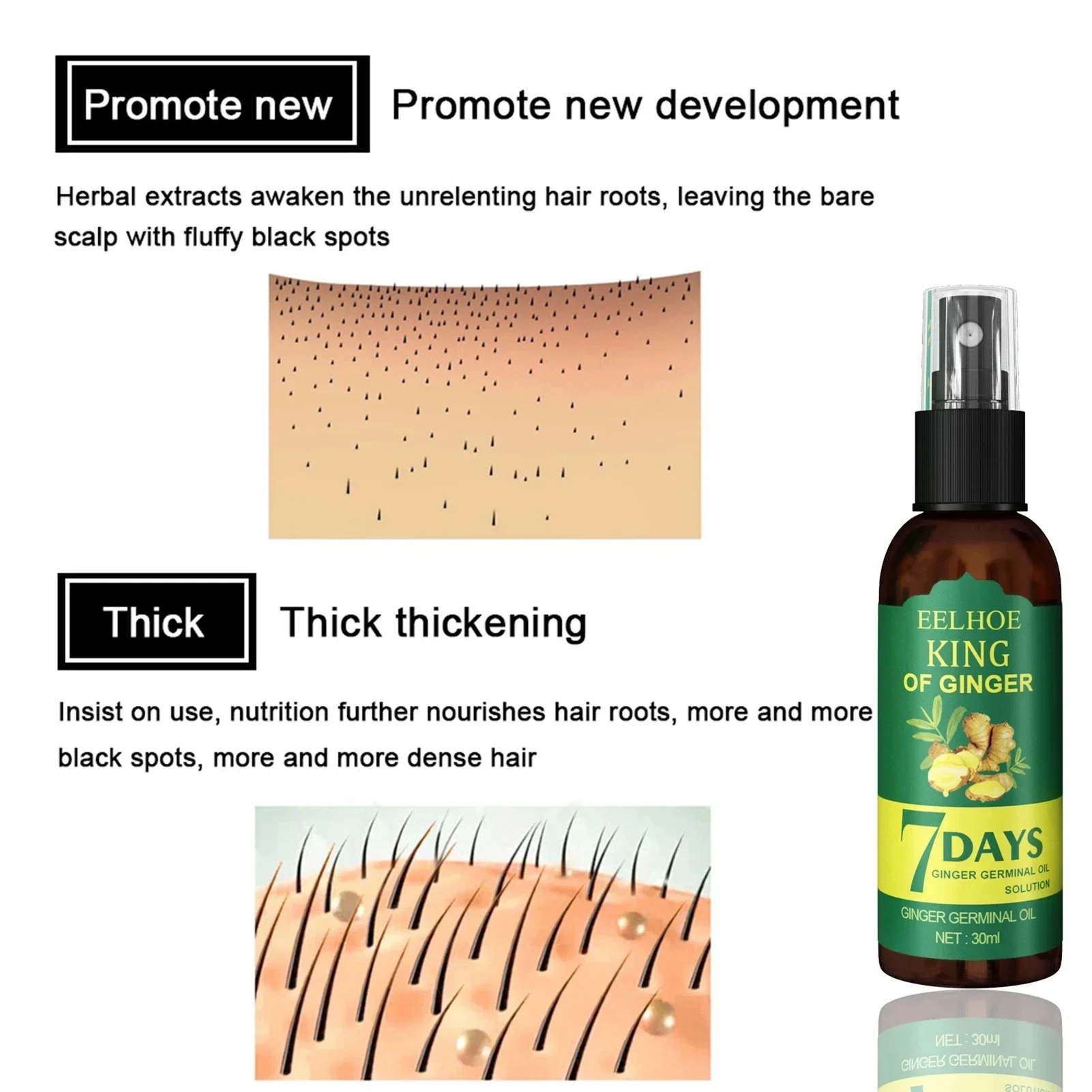 2024 Имбирная Сыворотка для ро – обзор и цена Epidermal Growth Factor